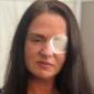 Woman poisoned by fake Botox used by beautician who apologises