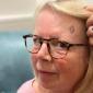 Digital imaging cuts waiting times for skin cancer